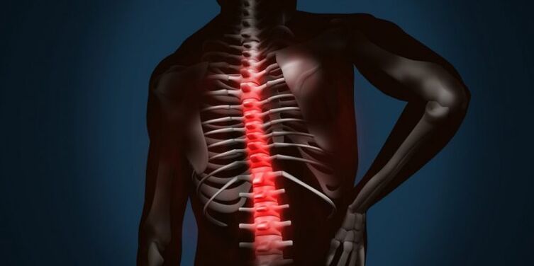 lezije kralježnice zbog osteohondroze